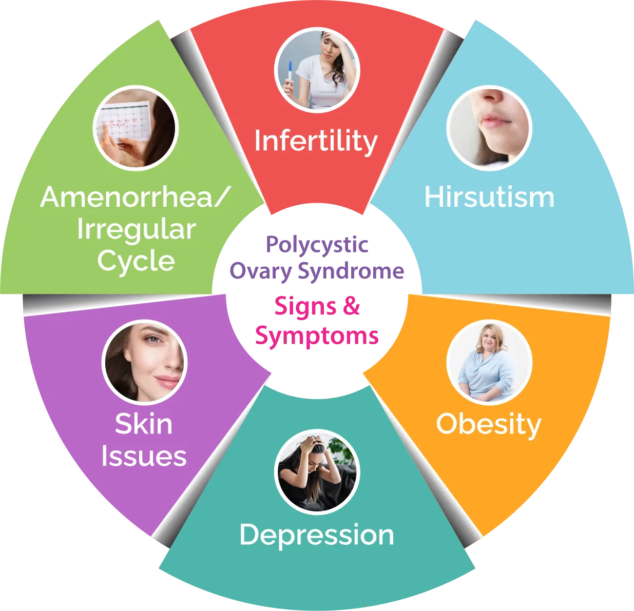 PCOS signs and symptoms chart for Feova-3 10 sachets